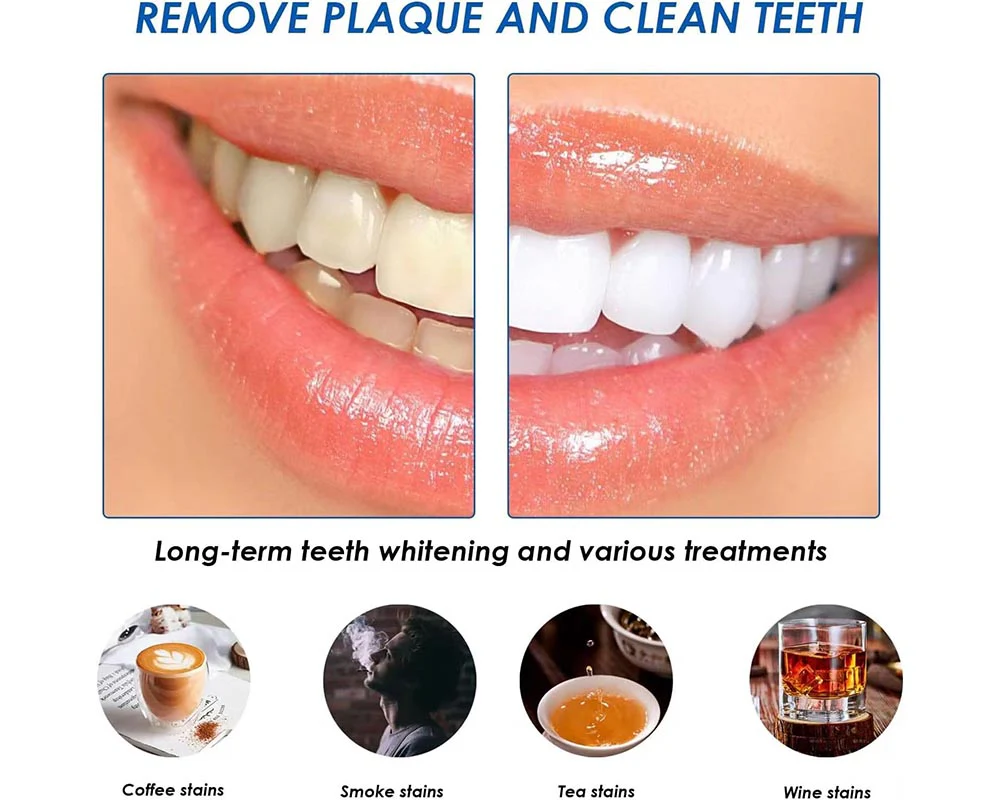 Teeth Whitening Strips kit - Image 4