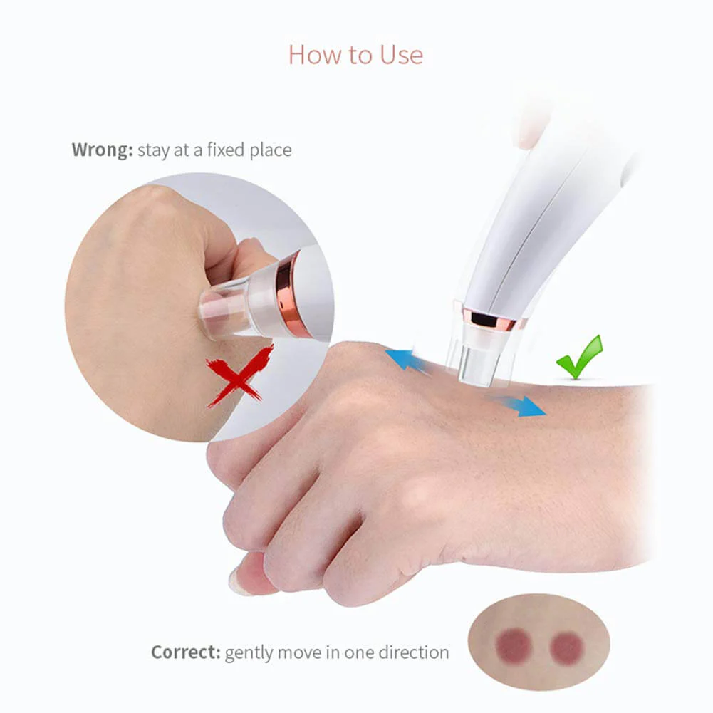 Acne Cleansing Blackhead Remover - Image 3