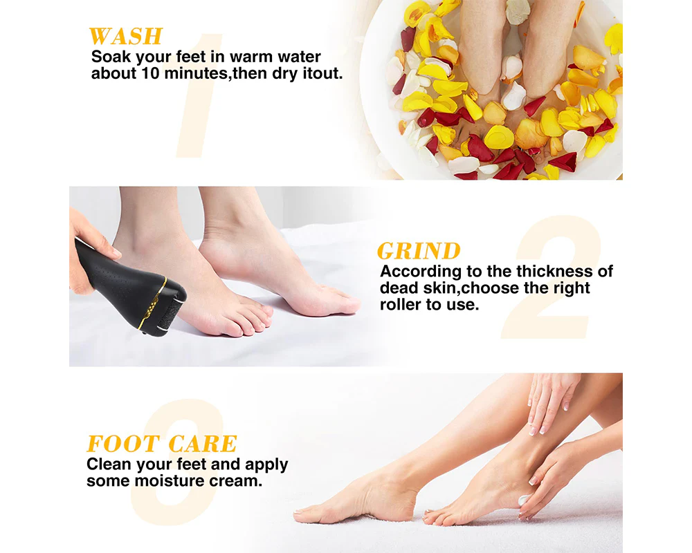 Electric Callus Remover Foot Pedicure Kit Rechargeable - Image 3