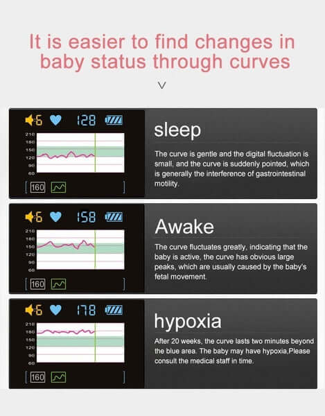 Fetal Doppler – Baby Heartbeat Monitor Prenatal Fetal Doppler - Image 5