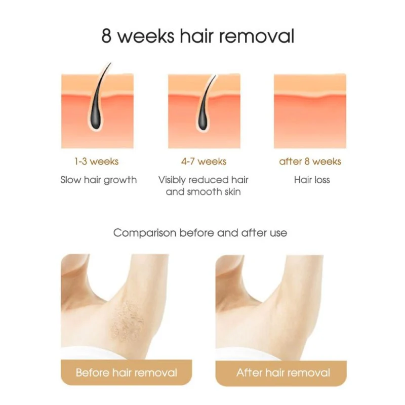 IPL Laser Hair Removal - Image 3