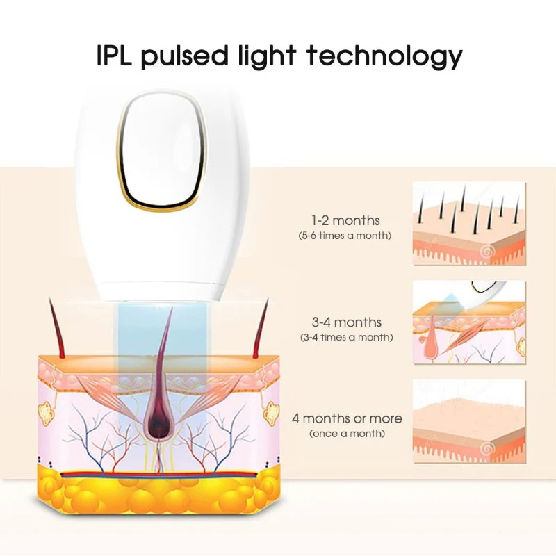 IPL Laser Hair Removal - Image 4
